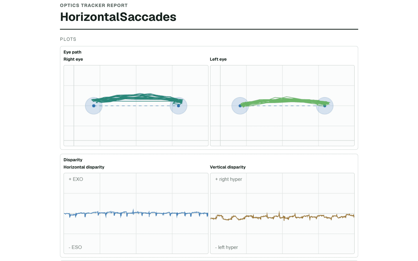 De-identified Optics Tracker Horizontal Saccades report preview